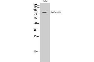 Western Blotting (WB) image for anti-Cortactin (CTTN) (Ser338) antibody (ABIN3174520) (Cortactin Antikörper  (Ser338))
