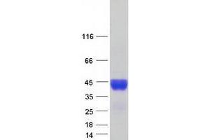Validation with Western Blot (C4BPB Protein (Transcript Variant 2) (Myc-DYKDDDDK Tag))