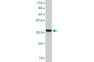Western Blotting (WB) image for anti-Solute Carrier Family 25, Member 13 (Citrin) (slc25a13) (AA 2-80) antibody (ABIN523541)
