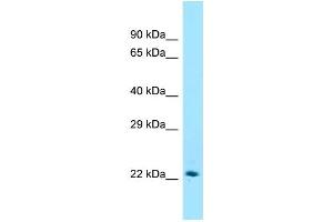 Western Blotting (WB) image for anti-ST6 beta-Galactosamide alpha-2,6-Sialyltranferase 1 (ST6GAL1) (C-Term) antibody (ABIN2789724)