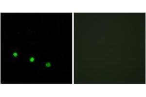 Immunofluorescence analysis of HuvEc cells treated with EGF 200nM 5', using FosB (Phospho-Ser27) Antibody. (FOSB Antikörper  (pSer27))