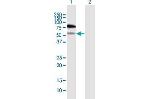 Western Blot analysis of RAD18 expression in transfected 293T cell line by RAD18 MaxPab polyclonal antibody. (RAD18 Antikörper  (AA 1-495))