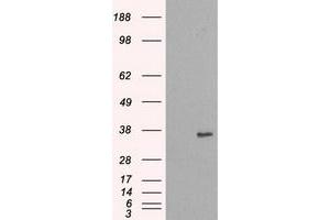 Image no. 2 for anti-NIMA (Never in Mitosis Gene A)-Related Kinase 6 (NEK6) antibody (ABIN1499685) (NEK6 Antikörper)