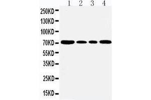Anti-GRP78 BiP antibody, Western blotting Lane 1: Rat Testis Tissue Lysate Lane 2: A549 Cell Lysate Lane 3: MCF-7 Cell Lysate Lane 4: HELA Cell Lysate (GRP78 Antikörper  (C-Term))