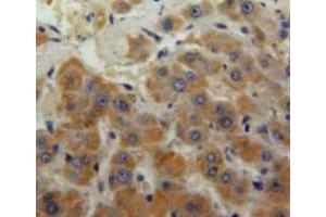 Used in DAB staining on fromalin fixed paraffin-embedded liver tissue (MSE Antikörper  (AA 3-434))
