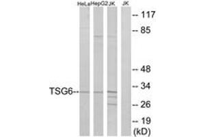 Western blot analysis of extracts from Jurkat/HeLa/HepG2 cells, using TSG6 Antibody.