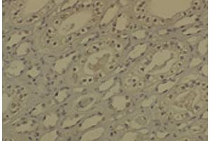 IHC analysis of DNMT1 in medullar kidney tissue sections using DNMT / DNMT1 antibody. (DNMT1 Antikörper  (AA 637-650) (PerCP))