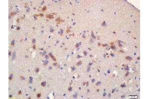 Formalin-fixed and paraffin embedded rat brain labeled with Rabbit Anti-mTOR (Ser2481) Polyclonal Antibody, Unconjugated 1:200 followed by conjugation to the secondary antibody and DAB staining (MTOR Antikörper  (pSer2481))