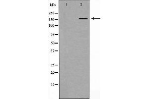 Western blot analysis of extracts of mouse lung, using DLC1 antibody.