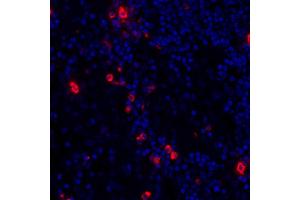 Immunofluorescence (IF) image for anti-Granzyme B (GZMB) (AA 19-247) antibody (ABIN7449554) (Rekombinanter GZMB Antikörper  (AA 19-247))