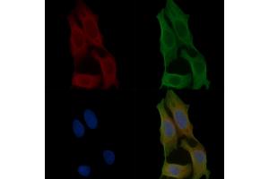 ABIN6257743 and ABIN6275677 staining Hela cells(45 min of heat-shock) by IF/ICC.