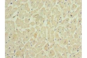 Immunohistochemistry of paraffin-embedded human heart tissue using ABIN7159179 at dilution of 1:100