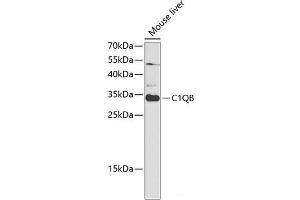 Western blot analysis of extracts of Mouse liver using C1QB Polyclonal Antibody at dilution of 1:1000. (C1QB Antikörper)