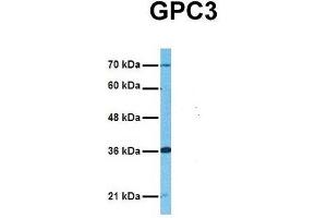 Host:  Rabbit  Target Name:  GPC3  Sample Tissue:  Human Adult Placenta  Antibody Dilution:  1. (Glypican 3 Antikörper  (Middle Region))