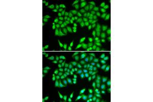 Immunofluorescence analysis of U2OS cells using MCM3 antibody.