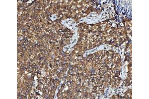 IHC analysis of CBR1 using anti-CBR1 antibody (ABIN7600015). (CBR1 Antikörper  (AA 14-262))
