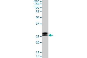 Western Blotting (WB) image for anti-Ring Finger Protein 141 (RNF141) (AA 141-230) antibody (ABIN599236) (RNF141 Antikörper  (AA 141-230))