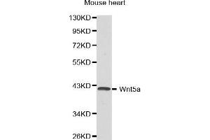 Western Blotting (WB) image for anti-Wingless-Type MMTV Integration Site Family, Member 5A (WNT5A) (AA 101-380) antibody (ABIN3023003) (WNT5A Antikörper  (AA 101-380))