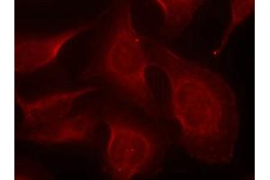 Immunofluorescence staining of methanol-fixed Hela cells using BIM(Phospho-Ser69) Antibody. (BIM Antikörper  (pSer69))