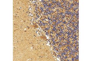 IHC analysis of FLT3 using anti-FLT3 antibody (ABIN7602257).