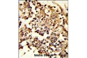 Formalin-fixed and paraffin-embedded human testis tissue reacted with HSPH1 Antibody (Center), which was peroxidase-conjugated to the secondary antibody, followed by DAB staining. (HSPH1 Antikörper  (AA 549-579))