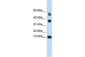 Western Blotting (WB) image for anti-Fatty Acid Binding Protein 3, Muscle and Heart (FABP3) (Middle Region) antibody (ABIN2782983)