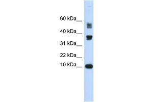 WB Suggested Anti-FABP3 Antibody Titration:  0. (FABP3 Antikörper  (Middle Region))