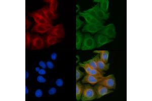 ABIN6259315 and ABIN6274430 staining Hela cells(45 min of heat-shock) by IF/ICC. (RGAG1 Antikörper  (C-Term))