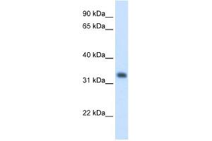 WB Suggested Anti-HMGCL Antibody Titration:  1.