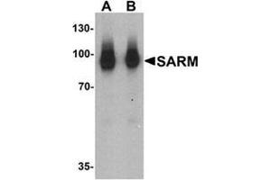 Western blot analysis of SARM in human kidney tissue lysate with SARM Antibody  at (A) 1 and (B) 2 ug/mL.