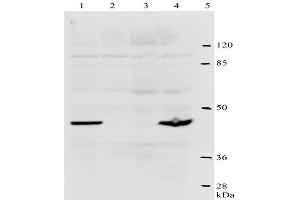 Western-Blot analysis of HPV-18 E2 protein.