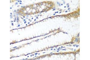 Immunohistochemistry of paraffin-embedded Human stomach using PPP4R1 Polyclonal Antibody at dilution of 1:100 (40x lens). (PPP4R1 Antikörper)