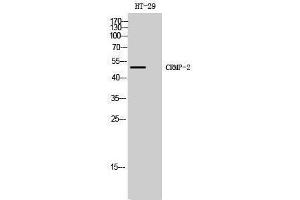 Western Blotting (WB) image for anti-Dihydropyrimidinase-Like 2 (DPYSL2) (Ser308) antibody (ABIN3174564) (DPYSL2 Antikörper  (Ser308))