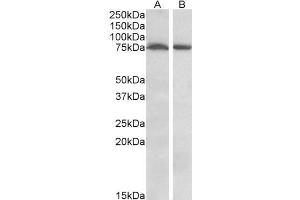 ABIN570996 (1µg/ml) staining of Mouse (A) and Rat (B) Brain (35µg protein in RIPA buffer). (STK39 Antikörper  (Internal Region))