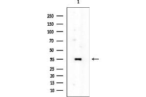 anti-RNA terminal Phosphate Cyclase Domain 1 (RTCD1) (C-Term) antibody