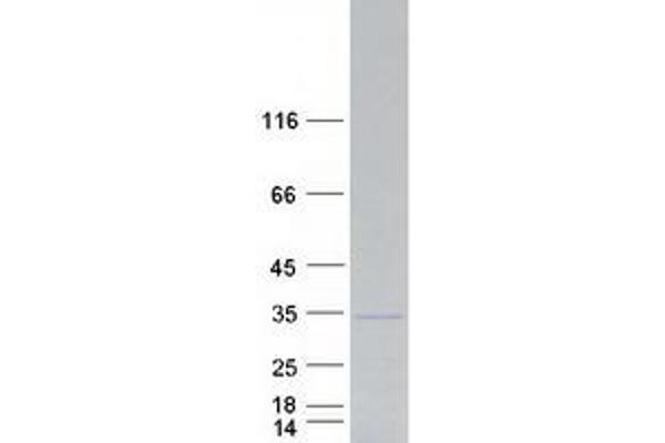 PROP1 Protein (Myc-DYKDDDDK Tag)