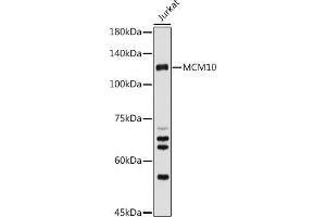 Western blot analysis of extracts of Jurkat cells, using MCM10 antibody (ABIN6129654, ABIN6143639, ABIN6143641 and ABIN6223024) at 1:500 dilution. (MCM10 Antikörper  (AA 616-875))