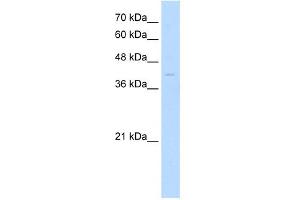WB Suggested Anti-MKX Antibody Titration: 0. (MKX Antikörper  (Middle Region))
