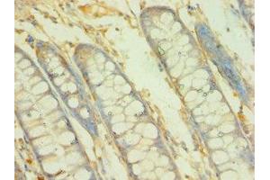 Immunohistochemistry of paraffin-embedded human colon tissue using ABIN7145745 at dilution of 1:100 (BCAT2 Antikörper  (AA 20-200))