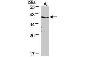 WB Image Sample(30 μg of whole cell lysate) A:A431, 12% SDS PAGE antibody diluted at 1:500 (TMEM59 Antikörper)