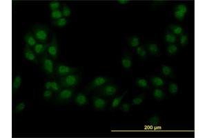 Immunofluorescence (IF) image for anti-serine/threonine Kinase 38 (STK38) (AA 365-465) antibody (ABIN7199721)