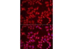 Immunofluorescence analysis of MCF7 cells using BAP1 antibody. (BAP1 Antikörper  (AA 460-729))