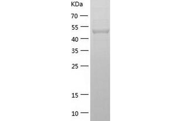 GBA3 Protein (AA 1-469) (His tag)