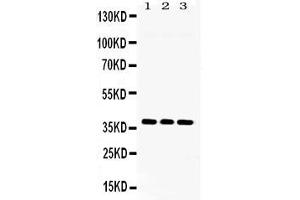 Western blot analysis of LDHB expression in rat brain extract ( Lane 1), NIH3T3 whole cell lysates ( Lane 2) and U2OS whole cell lysates ( Lane 3). (LDHB Antikörper  (AA 237-334))