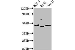 Western Blot Positive WB detected in: MCF-7 whole cell lysate, Raji whole cell lysate, HepG2 whole cell lysate All lanes: SERPINA11 antibody at 5 μg/mL Secondary Goat polyclonal to rabbit IgG at 1/50000 dilution Predicted band size: 47 kDa Observed band size: 47 kDa (SERPINA11 Antikörper  (AA 279-394))