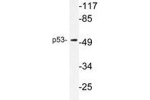 Western blot analysis of p53 antibody in extracts from COS7 cells. (p53 Antikörper)