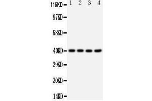 Western Blotting (WB) image for anti-Chemokine (C-X-C Motif) Receptor 1 (CXCR1) (AA 24-38), (N-Term) antibody (ABIN3042912) (CXCR1 Antikörper  (N-Term))