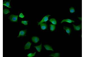 Immunofluorescence staining of A549 cells with ABIN7167931 at 1:200, counter-stained with DAPI. (ARHGAP15 Antikörper  (AA 1-154))