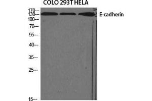 Western Blot (WB) analysis of specific cells using E-cadherin Polyclonal Antibody.