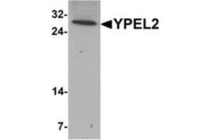 Western blot analysis of YPEL2 in HeLa cell lysate with YPEL2 antibody at 1 ug/mL. (YPEL2 Antikörper  (N-Term))